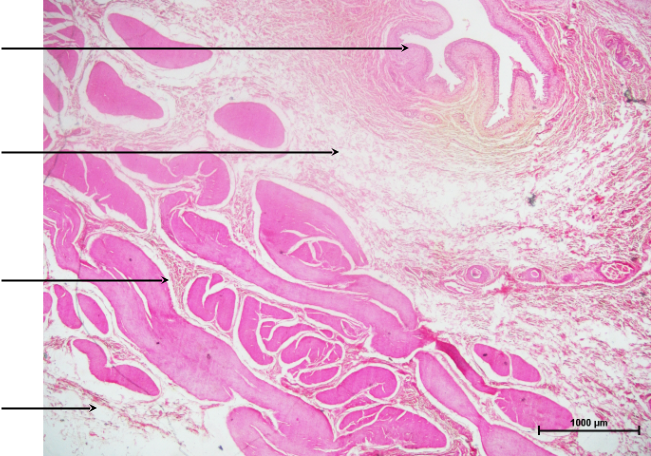 Bladder 1